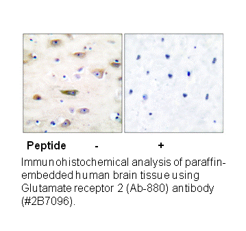 Product image for GluR2 (Ab-880) Antibody