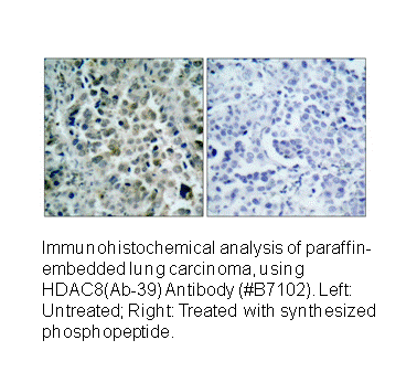 Product image for HDAC8 (Ab-39) Antibody