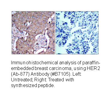 Product image for HER2 (Ab-877) Antibody