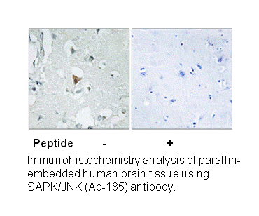 Product image for SAPK/JNK (Ab-185) Antibody