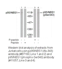 Product image for p95/NBS1 (Ab-343) Antibody