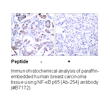 Product image for NF-&kappa;B p65 (Ab-254) Antibody