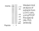 Product image for PDGF Receptor &beta; (Ab-752) Antibody