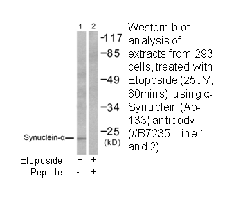 Product image for Synuclein-&alpha; (Ab-133) Antibody