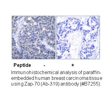 Product image for ZAP-70 (Ab-319) Antibody
