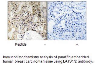 Product image for LATS1/2 (Ab-1079/1041) Antibody