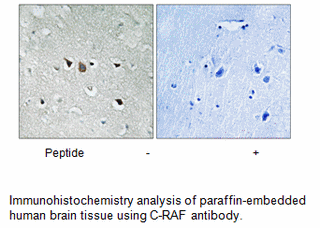 Product image for C-RAF (Ab-269) Antibody