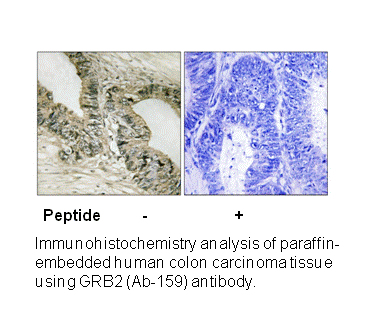 Product image for GRB2 (Ab-159) Antibody