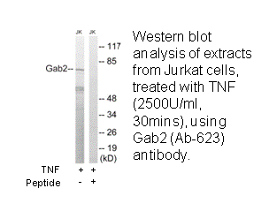 Product image for Gab2 (Ab-623) Antibody