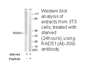 Product image for RAD51 (Ab-309) Antibody
