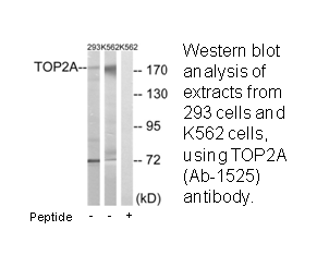 Product image for TOP2A (Ab-1525) Antibody