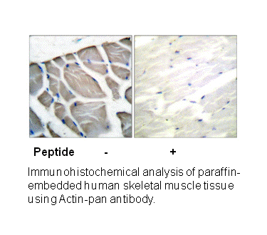 Product image for Actin-pan Antibody