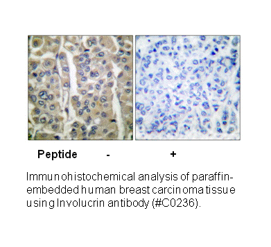Product image for Involucrin Antibody