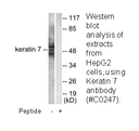 Product image for Keratin 7 Antibody
