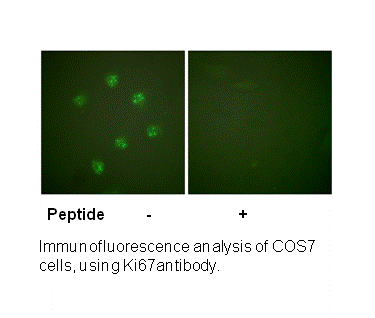 Product image for Ki67 Antibody