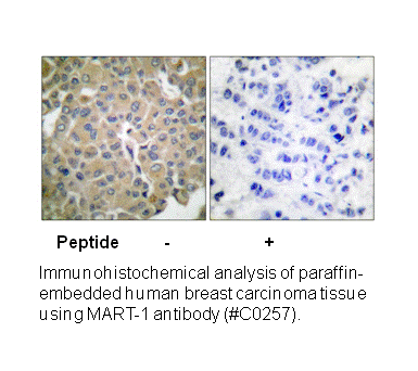 Product image for MART-1 Antibody