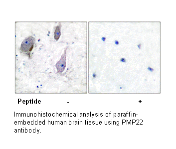 Product image for PMP22 Antibody