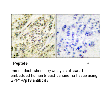 Product image for SKP1A/p19 Antibody