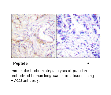 Product image for PIAS3 Antibody