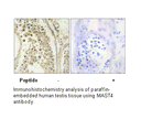 Product image for MAST4 Antibody