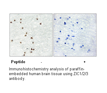 Product image for ZIC1/2/3 Antibody