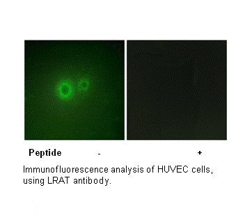 Product image for LRAT Antibody