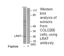 Product image for LRAT Antibody