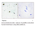 Product image for ABL1 Antibody