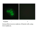 Product image for M-CK Antibody