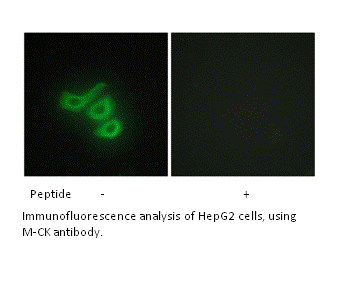 Product image for M-CK Antibody