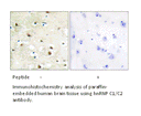 Product image for hnRNP C1/C2 Antibody