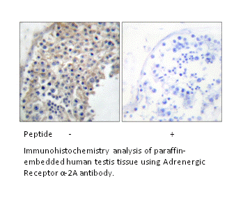 Product image for Adrenergic Receptor &alpha;-2A Antibody