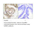 Product image for hnRNP L Antibody