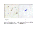Product image for B-RAF Antibody