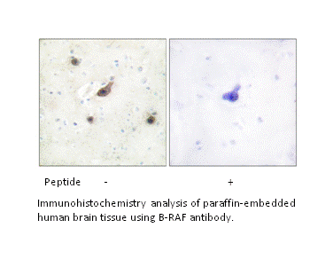 Product image for B-RAF Antibody