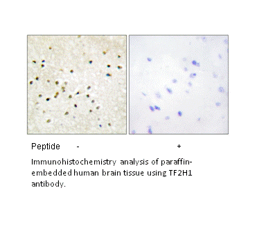 Product image for TF2H1 Antibody