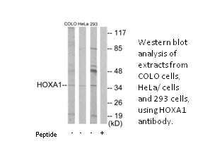 Product image for HOXA1 Antibody