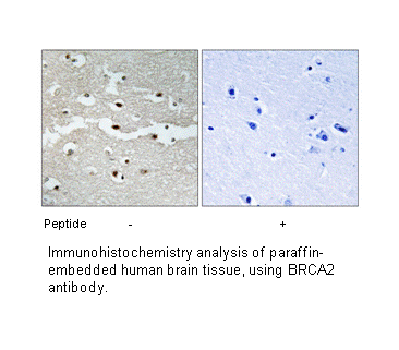 Product image for BRCA2 Antibody
