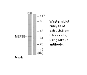 Product image for MEF2B Antibody
