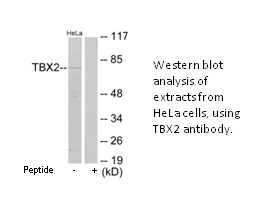 Product image for TBX2 Antibody