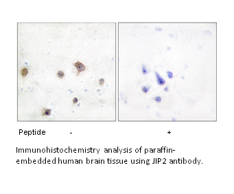 Product image for JIP2 Antibody