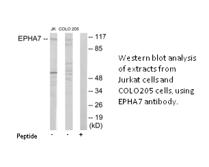 Product image for EPHA7 Antibody
