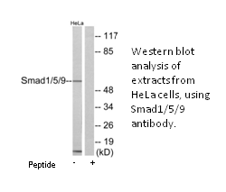 Product image for Smad1/5/9 Antibody