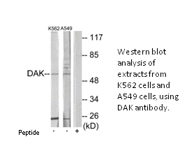 Product image for DAK Antibody