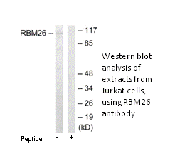 Product image for RBM26 Antibody