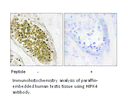 Product image for HIPK4 Antibody
