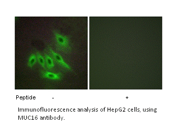 Product image for MUC16 Antibody