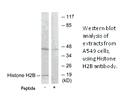Product image for Histone H2B Antibody