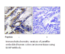 Product image for ILKAP Antibody