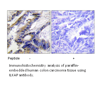 Product image for ILKAP Antibody
